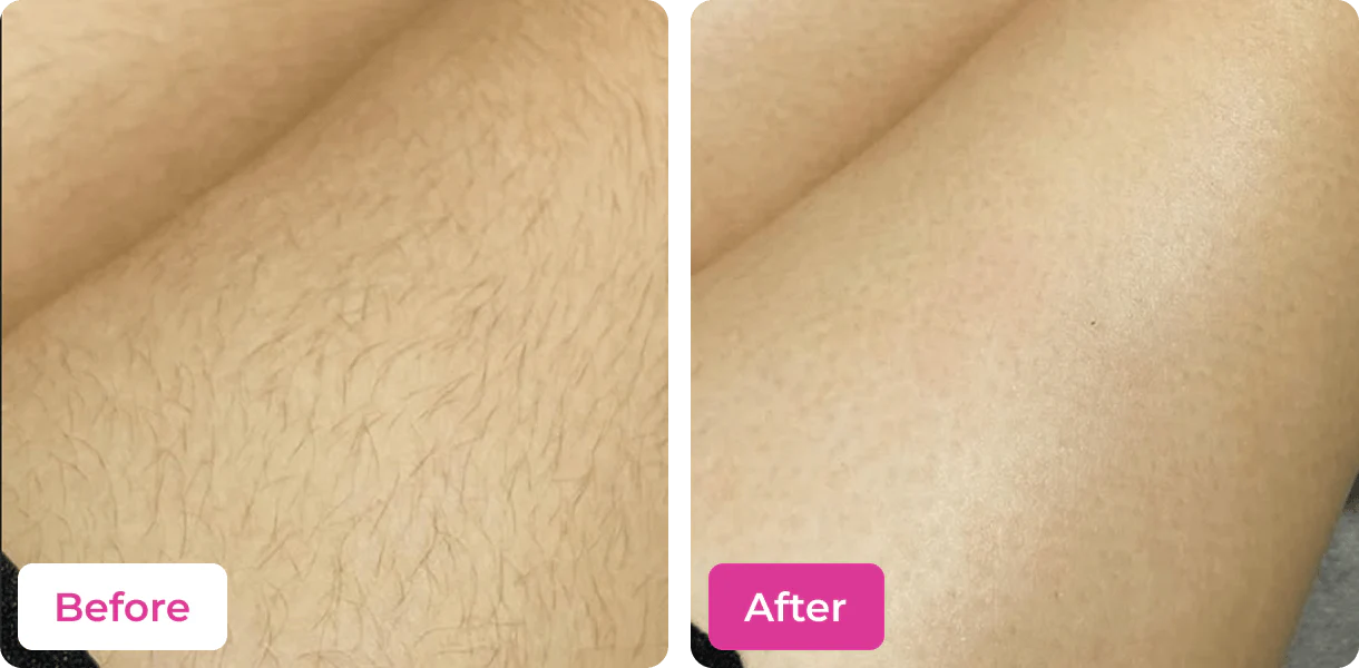 MEOW BODY HAIR REMOVAL WAX POWDER - BUY 1 GET 1 FREE