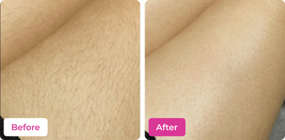 MEOW BODY HAIR REMOVAL WAX POWDER - BUY 1 GET 1 FREE