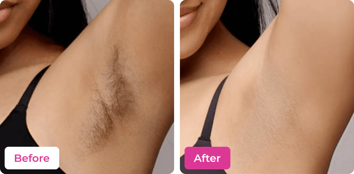 MEOW BODY HAIR REMOVAL WAX POWDER - BUY 1 GET 1 FREE