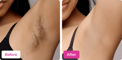 MEOW BODY HAIR REMOVAL WAX POWDER - BUY 1 GET 1 FREE