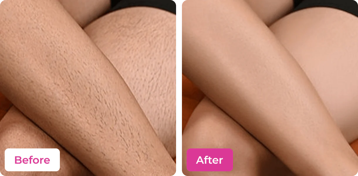 MEOW BODY HAIR REMOVAL WAX POWDER - BUY 1 GET 1 FREE