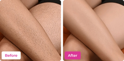 MEOW BODY HAIR REMOVAL WAX POWDER - BUY 1 GET 1 FREE