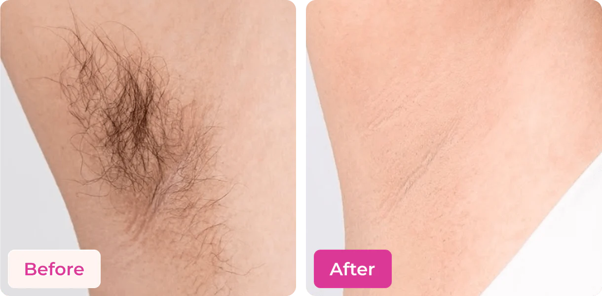 MEOW BODY HAIR REMOVAL WAX POWDER - BUY 1 GET 1 FREE