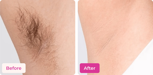 MEOW BODY HAIR REMOVAL WAX POWDER - BUY 1 GET 1 FREE