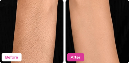 MEOW BODY HAIR REMOVAL WAX POWDER - BUY 1 GET 1 FREE